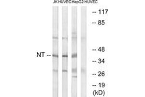 Western blot analysis of extracts from HuvEc/HepG2/Jurkat cells, using NT Antibody. (NT (AA 235-284) 抗体)