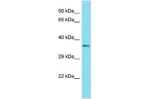Host: Rabbit Target Name: OR51B6 Sample Type: ACHN Whole Cell lysates Antibody Dilution: 1. (OR51B6 抗体  (C-Term))