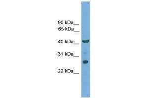 WB Suggested Anti-TMEM176A Antibody Titration:  0. (TMEM176A 抗体  (N-Term))