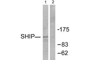 Western Blotting (WB) image for anti-Inositol Polyphosphate-5-Phosphatase, 145kDa (INPP5D) (C-Term) antibody (ABIN1848769) (INPP5D 抗体  (C-Term))