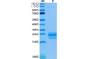 Human CD99 on Tris-Bis PAGE under reduced condition. (CD99 Protein (CD99) (AA 23-122) (His tag))