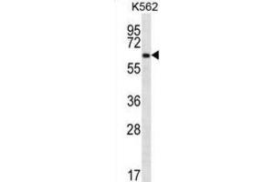 Western Blotting (WB) image for anti-Zinc Finger Protein 623 (ZNF623) antibody (ABIN2996914) (ZNF623 抗体)