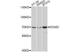 Western blot analysis of extracts of various cell lines, using KCNQ1 antibody (ABIN5971201) at 1/1000 dilution. (KCNQ1 抗体)