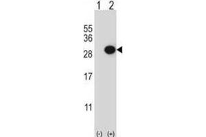 Western Blotting (WB) image for anti-Collagen Triple Helix Repeat Containing 1 (CTHRC1) antibody (ABIN3003906) (CTHRC1 抗体)