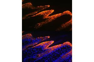 Immunofluorescence analysis of human skin using Cytokeratin 10 Rabbit mAb (ABIN1679404, ABIN3019133, ABIN3019134 and ABIN7101721) at dilution of 1:100 (40x lens). (Keratin 10 抗体)