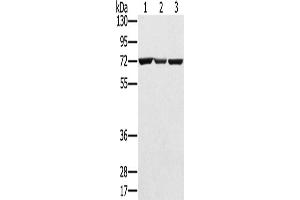 Western Blotting (WB) image for anti-Solute Carrier Family 25, Member 13 (Citrin) (slc25a13) antibody (ABIN2424162) (slc25a13 抗体)