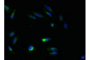 Immunofluorescent analysis of Hela cells using ABIN7144817 at dilution of 1:100 and Alexa Fluor 488-congugated AffiniPure Goat Anti-Rabbit IgG(H+L) (ATL3 抗体  (AA 1-187))