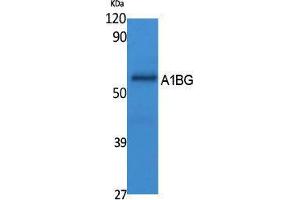 Western Blotting (WB) image for anti-alpha-1-B Glycoprotein (A1BG) (Internal Region) antibody (ABIN3178089) (A1BG 抗体  (Internal Region))