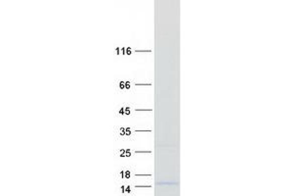 LST1 Protein (Transcript Variant 4) (Myc-DYKDDDDK Tag)