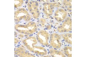 Immunohistochemistry of paraffin-embedded human kidney using ELMO3 antibody. (ELMO3 抗体)