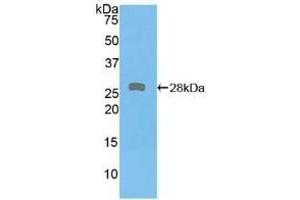 Detection of Recombinant PKD2, Human using Polyclonal Antibody to Protein Kinase D2 (PKD2) (PKD2 抗体  (AA 621-832))