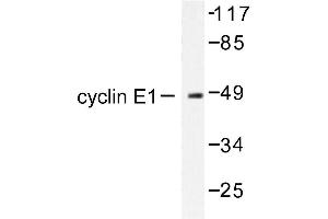 Image no. 1 for anti-Cyclin E1 (CCNE1) antibody (ABIN265379) (Cyclin E1 抗体)