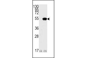 Western blot analysis of TP53(arrow) using rabbit polyclonal p53 Antibdoy (S15) (ABIN390201 and ABIN2840688). (p53 抗体  (AA 1-30))