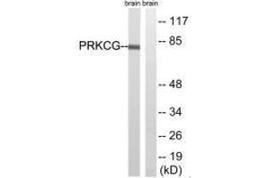 Western blot analysis of extracts from Rat brain cells, using PRKCG(Ab-655) antibody. (PKC gamma 抗体  (Thr655))