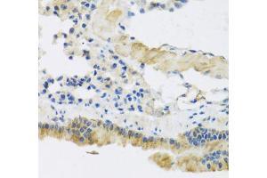 Immunohistochemistry of paraffin-embedded mouse lung using CLIP1 antibody (ABIN5975170) at dilution of 1/100 (40x lens). (CLIP1 抗体)