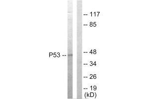 Western blot analysis of extracts from HepG2 cells, using p53 antibody. (p53 抗体  (C-Term))