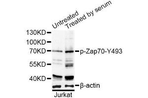 Western blot analysis of extracts of Jurkat cells, using Phospho-ZAP70-Y493 antibody (ABIN2988352) at 1/1000 dilution. (ZAP70 抗体  (pTyr493))