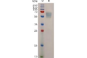 Mouse S Protein, His Tag on SDS-PAGE under reducing condition. (Stabilin 1 Protein (STAB1) (AA 638-1024) (His tag))