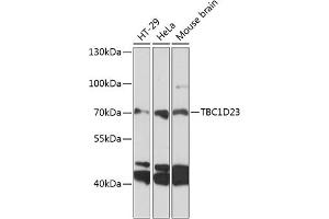 Western blot analysis of extracts of various cell lines, using TBC1D23 antibody (ABIN6133202, ABIN6148882, ABIN6148883 and ABIN6224939) at 1:3000 dilution. (TBC1D23 抗体  (AA 250-600))
