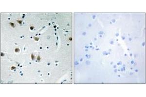 Immunohistochemistry analysis of paraffin-embedded human brain tissue, using ZNF148 Antibody. (ZNF148 抗体  (AA 61-110))