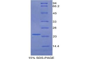 SDS-PAGE analysis of Mouse GAS6 Protein. (GAS6 蛋白)