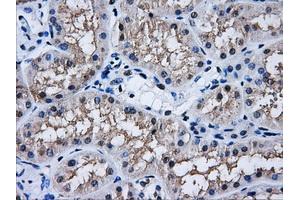 Immunohistochemistry (IHC) image for anti-Aldo-Keto Reductase Family 1, Member A1 (Aldehyde Reductase) (AKR1A1) antibody (ABIN1496542) (AKR1A1 抗体)