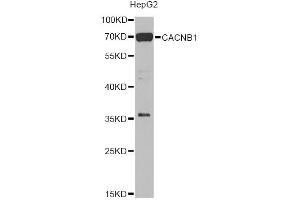 Western blot analysis of extracts of HepG2 cells, using CACNB1 Antibody (ABIN2736384) at 1:1000 dilution. (CACNB1 抗体)