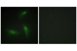 Immunofluorescence analysis of HeLa cells, using hnRNP A1 antibody. (HNRNPA1 抗体  (Internal Region))