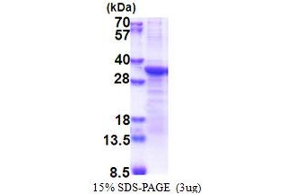 PCSK1N Protein (AA 34-260) (His tag)