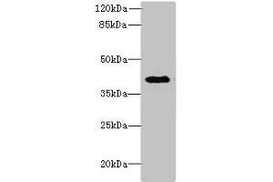 Western blot All lanes: DCN antibody at 6 μg/mL + Jurkat whole cell lysate Secondary Goat polyclonal to rabbit IgG at 1/10000 dilution Predicted band size: 40 kDa Observed band size: 40 kDa (Decorin 抗体  (AA 31-360))