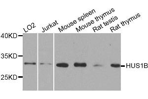 Western blot analysis of extracts of various cell lines, using HUS1B antibody. (HUS1B 抗体  (AA 1-278))