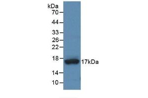 Detection of Recombinant ADAMTS4, Human using Monoclonal Antibody to A Disintegrin And Metalloproteinase With Thrombospondin 4 (ADAMTS4) (ADAMTS4 抗体  (AA 437-575))