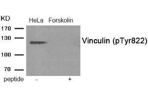 Western blot analysis of extracts from HeLa cells treated with Forskolin using Phospho-Vinculin (Tyr822) antibody. (Vinculin 抗体  (pTyr822))