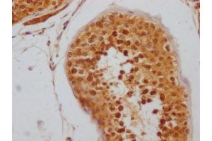 IHC image of ABIN7127796 diluted at 1:100 and staining in paraffin-embedded human testis tissue performed on a Leica BondTM system. (Recombinant RNF2 抗体)