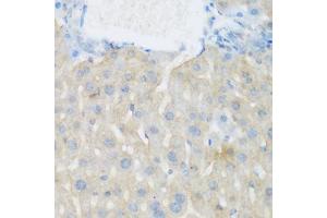 Immunohistochemistry of paraffin-embedded mouse liver using EGFR antibody (ABIN5997650) at dilution of 1/100 (40x lens). (EGFR 抗体)