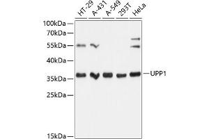 Western blot analysis of extracts of various cell lines, using UPP1 Antibody (ABIN6128903, ABIN6149952, ABIN6149953 and ABIN6216895) at 1:3000 dilution. (UPP1 抗体  (AA 89-173))