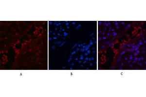 Immunofluorescence analysis of human appendix tissue. (NF-kB p65 抗体  (acLys310))