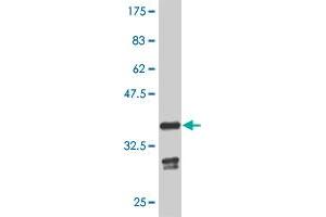 Western Blot detection against Immunogen (35. (GBX2 抗体  (AA 141-230))