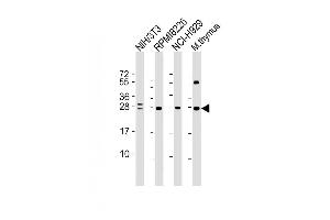 Lane 1: NIH/3T3 Cell lysates, Lane 2: RPMI8226 Cell lysates, Lane 3: NCI-H929 Cell lysates, Lane 4: mouse thymus lysates, probed with FGFR1OP2 (1675CT713. (FGFR1OP2 抗体)