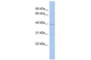 FLJ33790 antibody used at 1 ug/ml to detect target protein. (FLJ33790 (N-Term) 抗体)