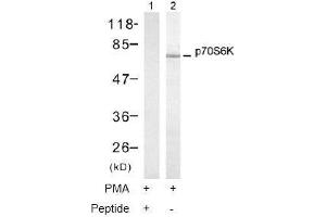 Image no. 1 for anti-Ribosomal Protein S6 Kinase, 70kDa, Polypeptide 1 (RPS6KB1) (Thr421) antibody (ABIN197499) (RPS6KB1 抗体  (Thr421))