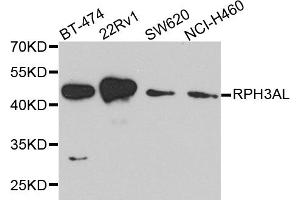 Western blot analysis of extracts of various cell lines, using RPH3AL antibody. (RPH3AL 抗体)