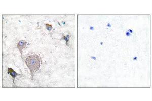 Immunohistochemistry (IHC) image for anti-Peripherin (PRPH) (C-Term) antibody (ABIN1848741) (Peripherin 抗体  (C-Term))