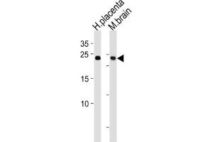 Western Blotting (WB) image for anti-SRY (Sex Determining Region Y)-Box 15 (SOX15) antibody (ABIN2996770) (SOX15 抗体)