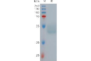 Human GIPR Protein, hFc Tag on SDS-PAGE under reducing condition. (GIPR Protein (AA 22-138) (Fc Tag))