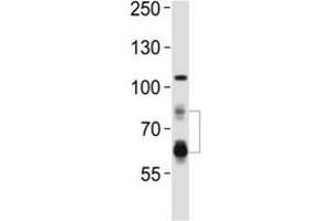 Western blot analysis of lysate from HeLa cell line using PCSK9 antibody. (PCSK9 抗体  (AA 144-173))