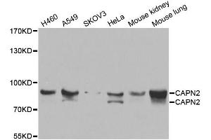 Western blot analysis of extracts of various cell lines, using CAPN2 antibody (ABIN5975337) at 1/1000 dilution. (Calpain 2 抗体)