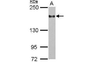 WB Image Sample (30 ug of whole cell lysate) A: THP-1 5% SDS PAGE antibody diluted at 1:2000 (ITGAL 抗体  (Internal Region))