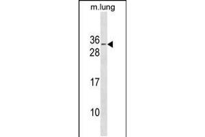 Western blot analysis in mouse lung tissue lysates (35ug/lane). (RBM7 抗体  (C-Term))