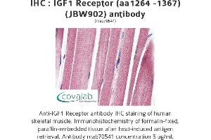 Image no. 1 for anti-Insulin-Like Growth Factor 1 Receptor (IGF1R) (AA 1264-1367) antibody (ABIN1723400) (IGF1R 抗体  (AA 1264-1367))